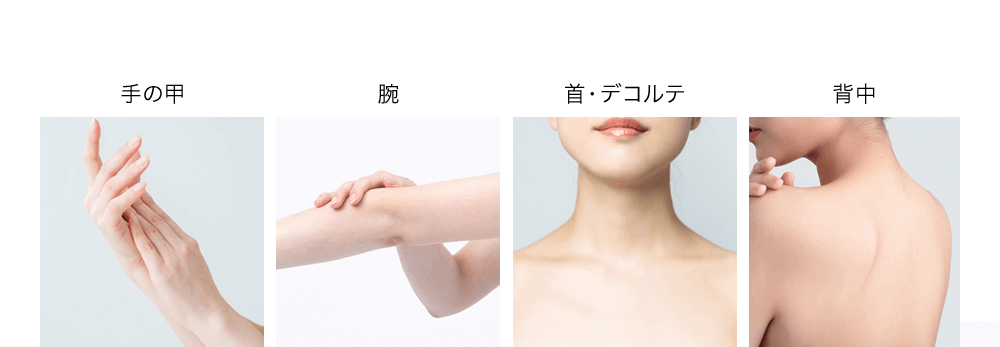 手の甲腕首・デコルテ背中