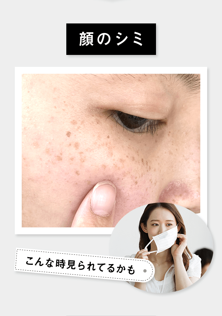 顔のシミ こんなとき見られてるかも