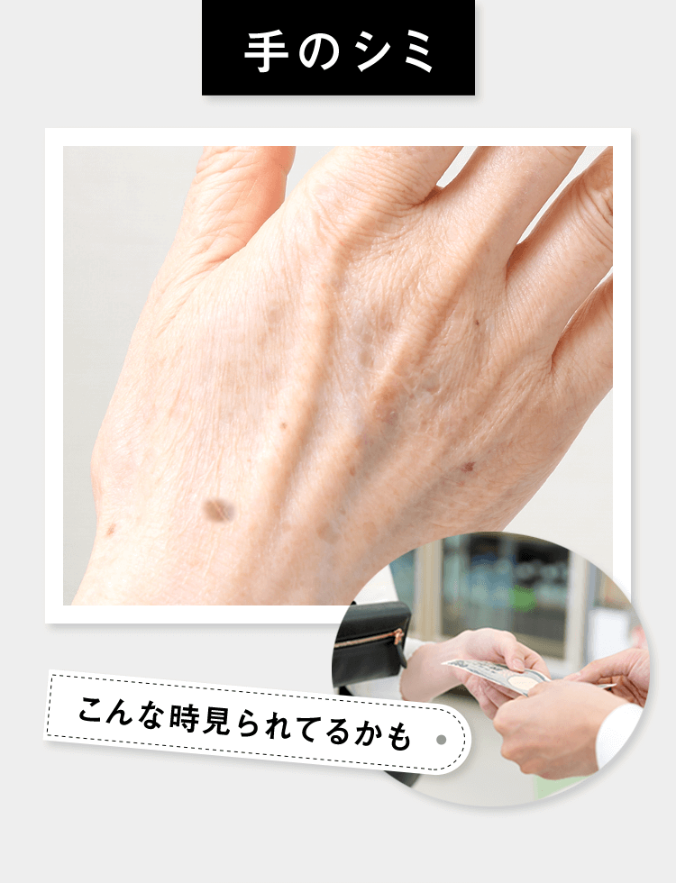 手のシミ こんなとき見られてるかも