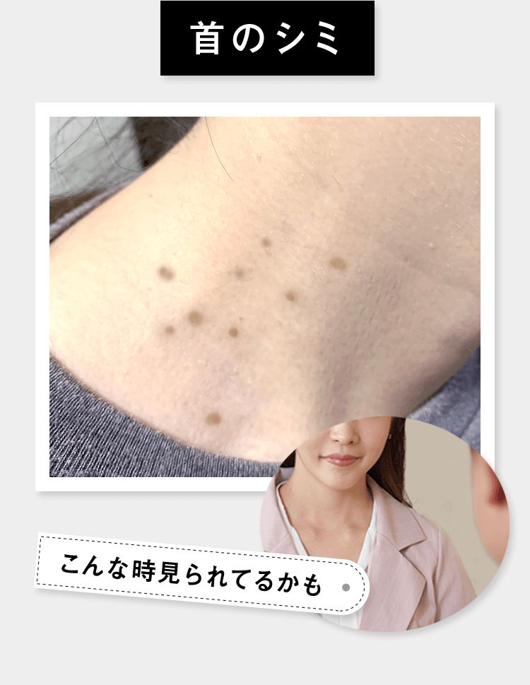 首のシミ こんなとき見られてるかも