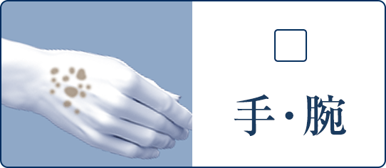 手・腕
