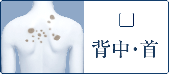 背中・首