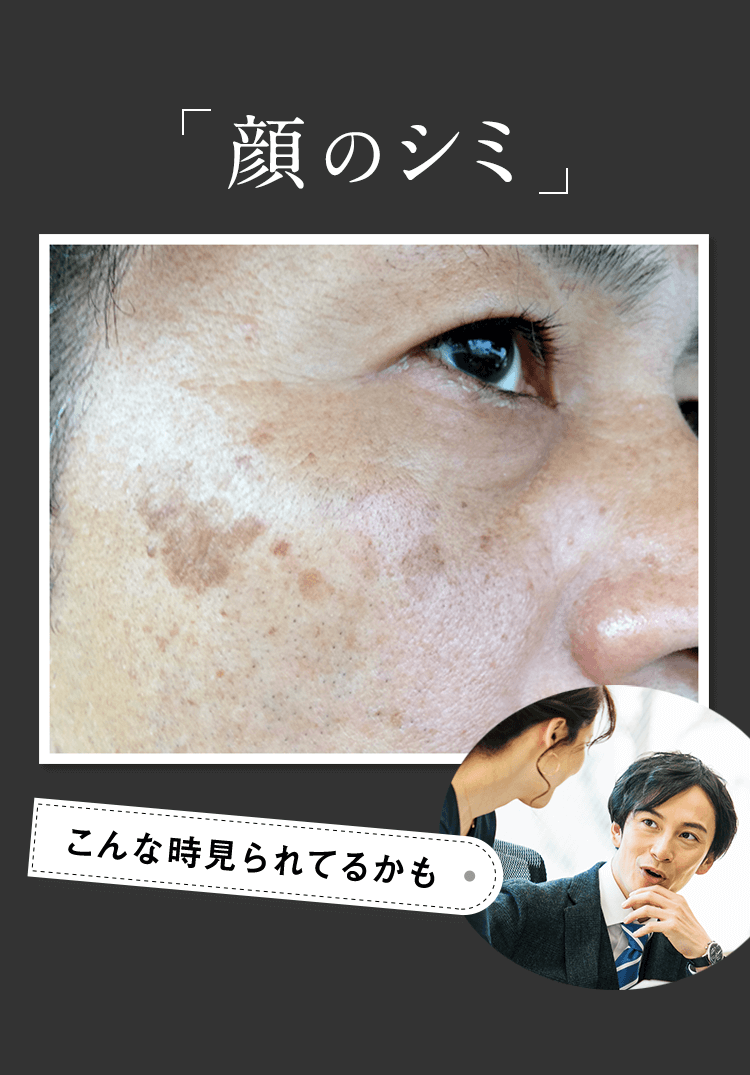 顔のシミ こんなとき見られてるかも