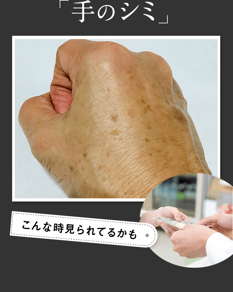 手のシミ こんなとき見られてるかも