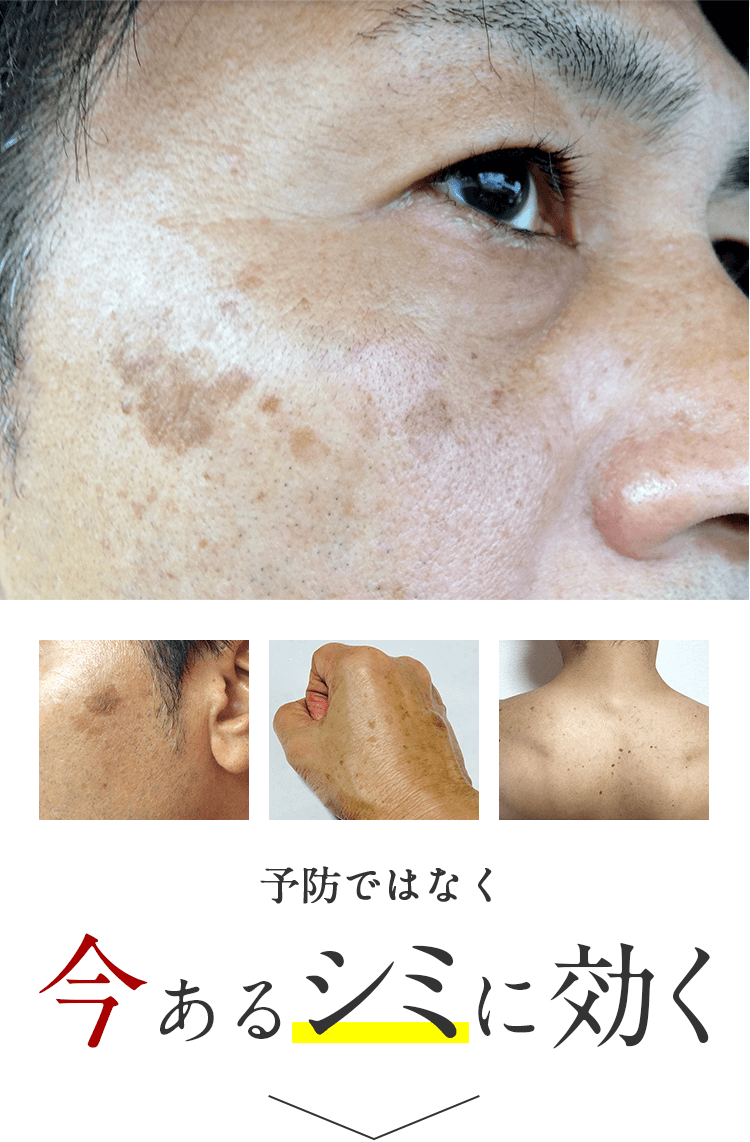 予防ではなく、今あるシミに効く