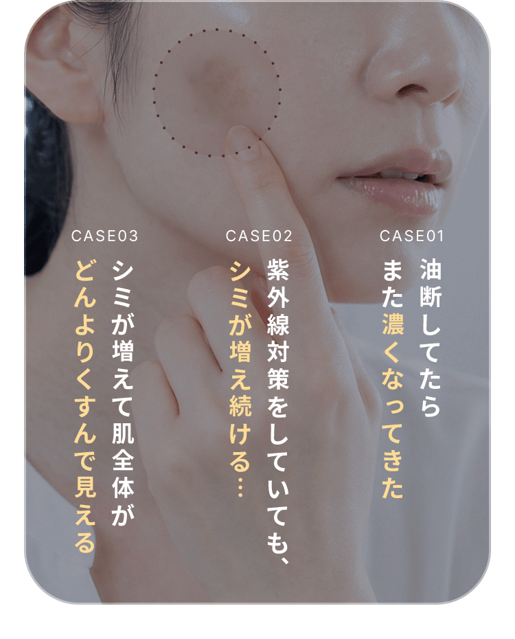 case01 油断してたら また濃くなってきた case02 紫外線対策をしていても、シミが増え続ける… case03 シミが増えて肌全体が どんよりくすんで見える