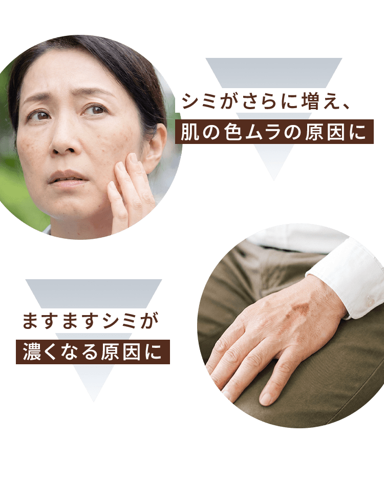 シミがさらに増え、肌の色ムラの原因に ますますシミが濃くなる原因に
