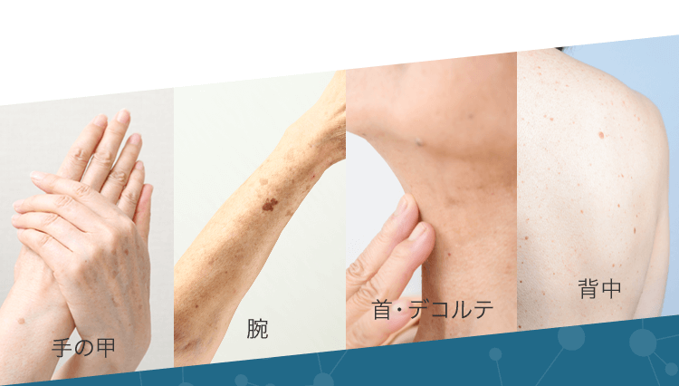 手の甲腕首・デコルテ背中