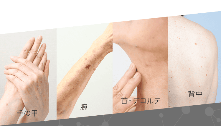 手の甲腕首・デコルテ背中