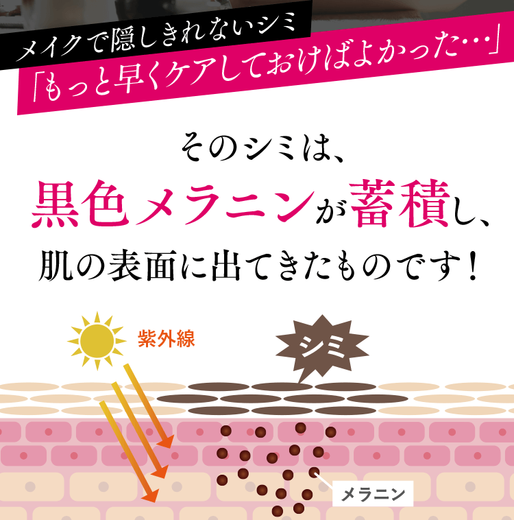 メイクで隠しきれないシミ「もっと早くケアしておけばよかった…」そのシミは、黒色メラニンが蓄積し、肌の表面に出てきたものです！