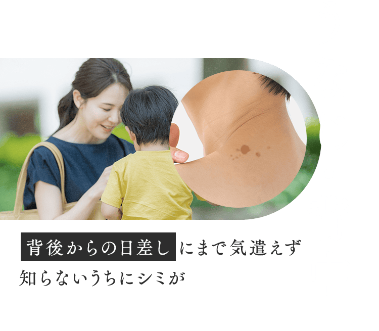 【うなじ・背中】背後からの日差しにまで気遣えず 知らないうちにシミが